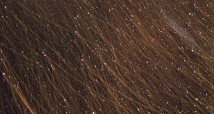 dandruff dandruff shampoo dandruff treatment anti dandruff shampoo best shampoo for dandruff best anti dandruff shampoo nizoral anti dandruff shampoo dandruff treatment at home dandruff home remedies flaky scalp itchy scalp no dandruff beard dandruff dandruff solution best dandruff treatment anti dandruff scalpe