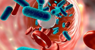 sepsis representation using graphics