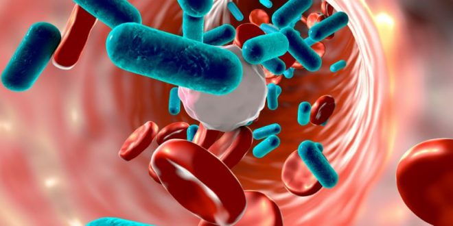 sepsis representation using graphics